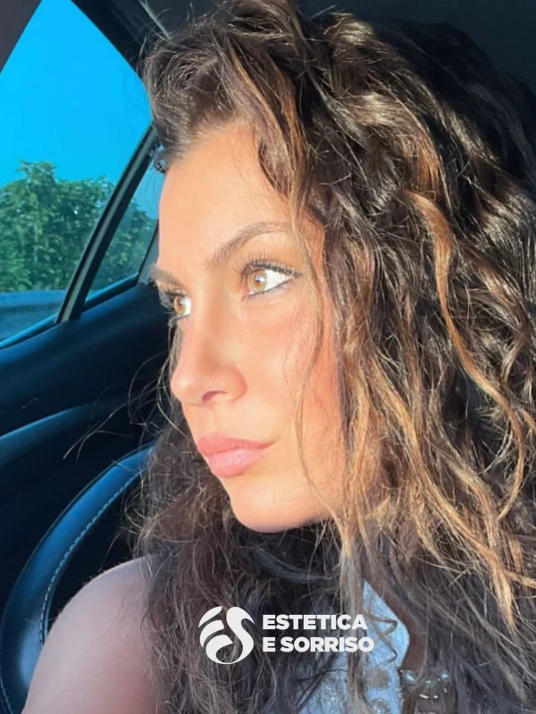 Rinoplastica - Estetica e Sorriso